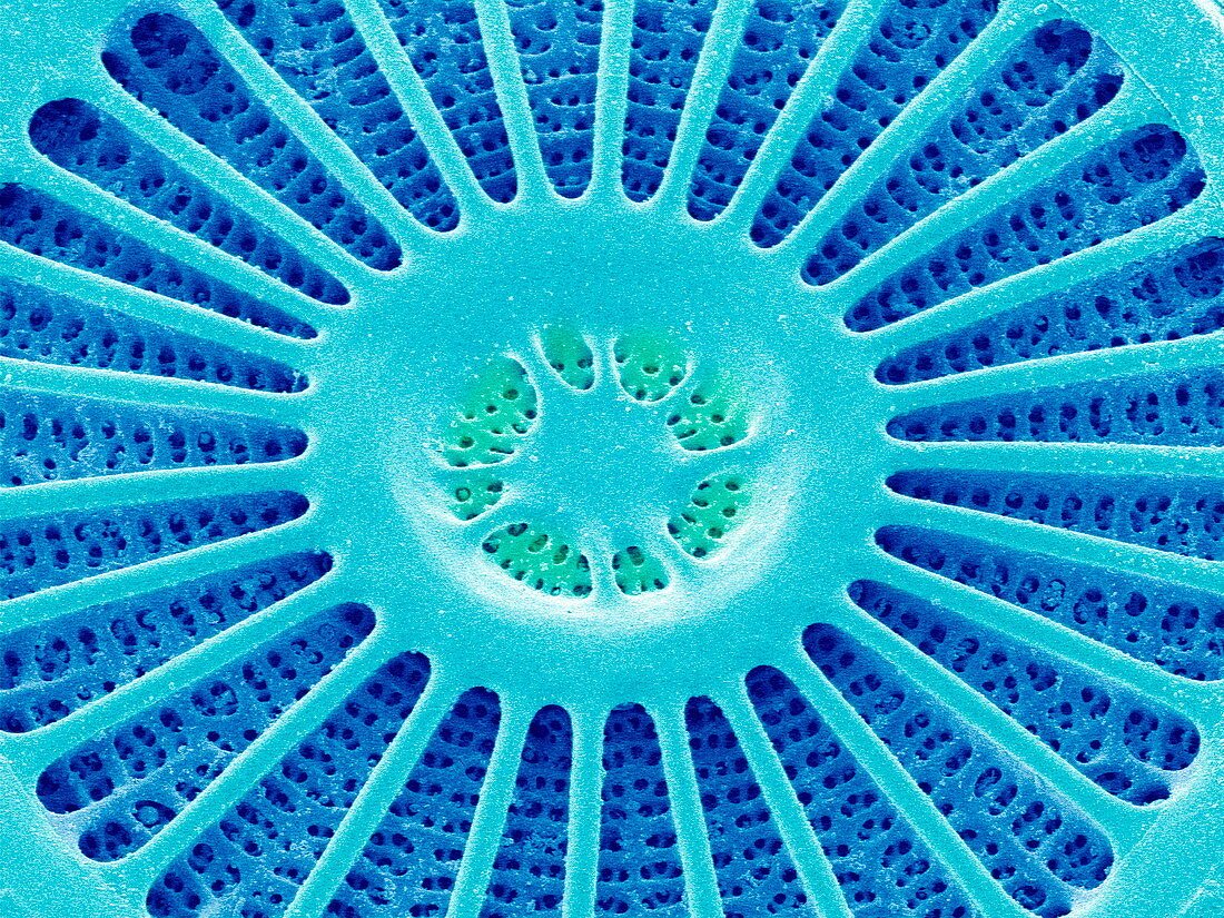 Diatom alga,SEM