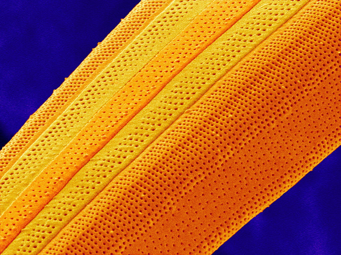 Marine diatom alga,SEM