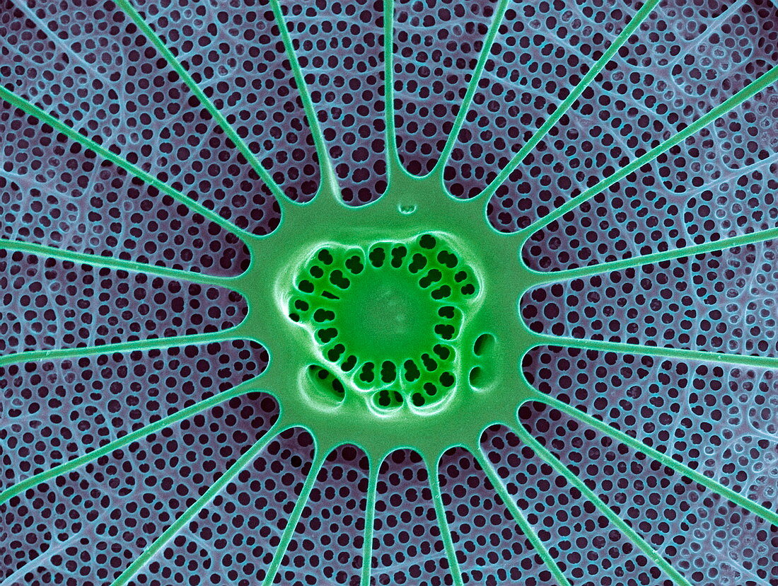 Diatom,SEM