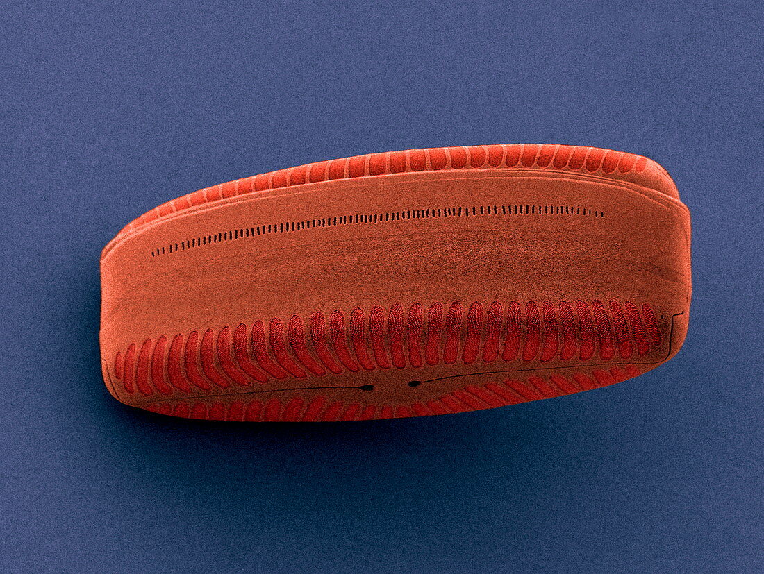 Diatom,SEM