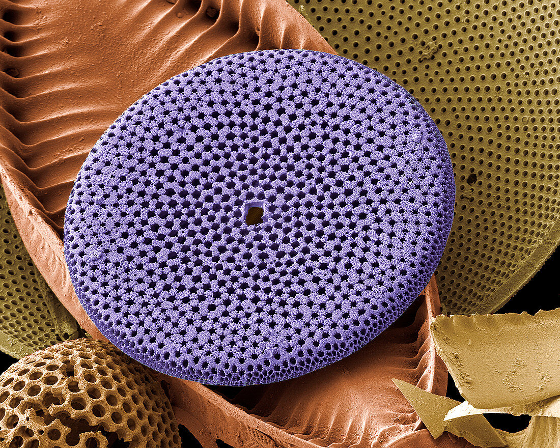 Diatoms,SEM