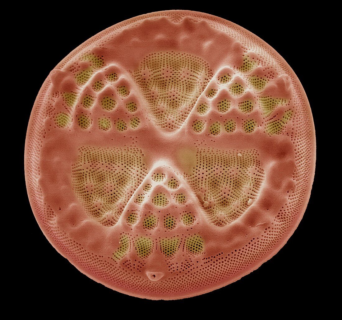 Diatom,SEM