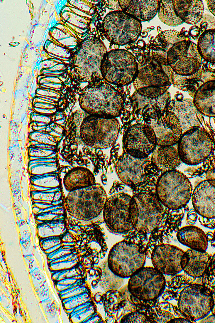 Sporophyte capsule of the liverwort