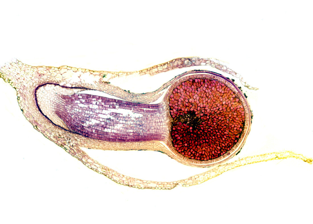 Liverwort spore case,light micrograph