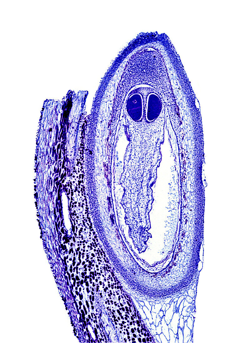 Pine cone scale,light micrograph