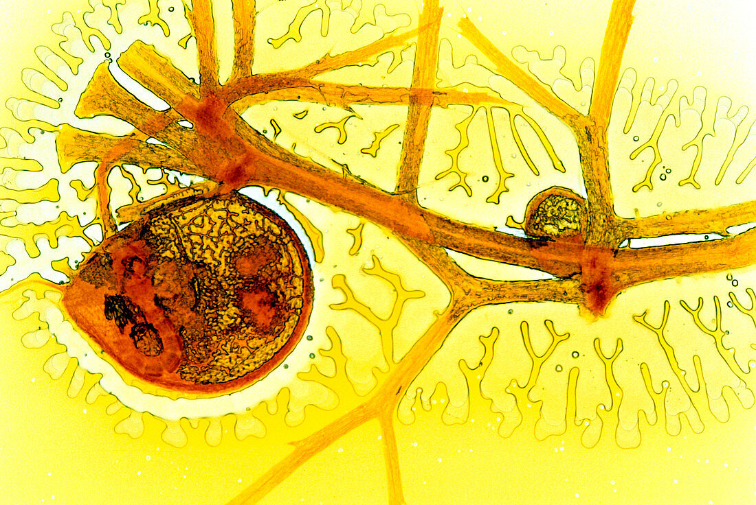Bladderwort bladder,light micrograph