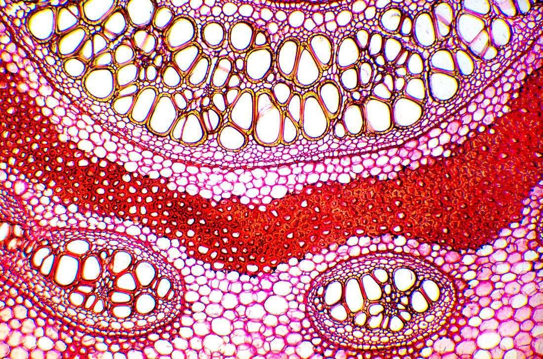 Bracken rhizome,light micrograph
