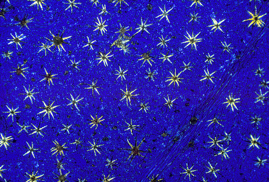 Stellate leaf hairs,light micrograph