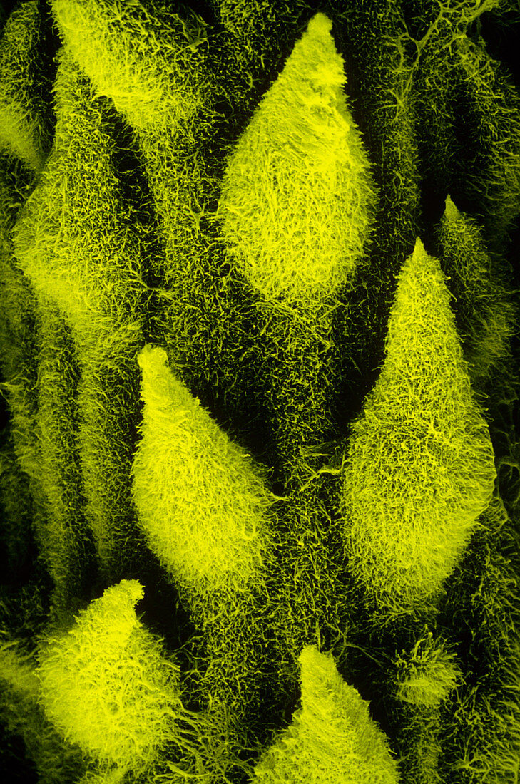 SEM of leaf surface of marram grass