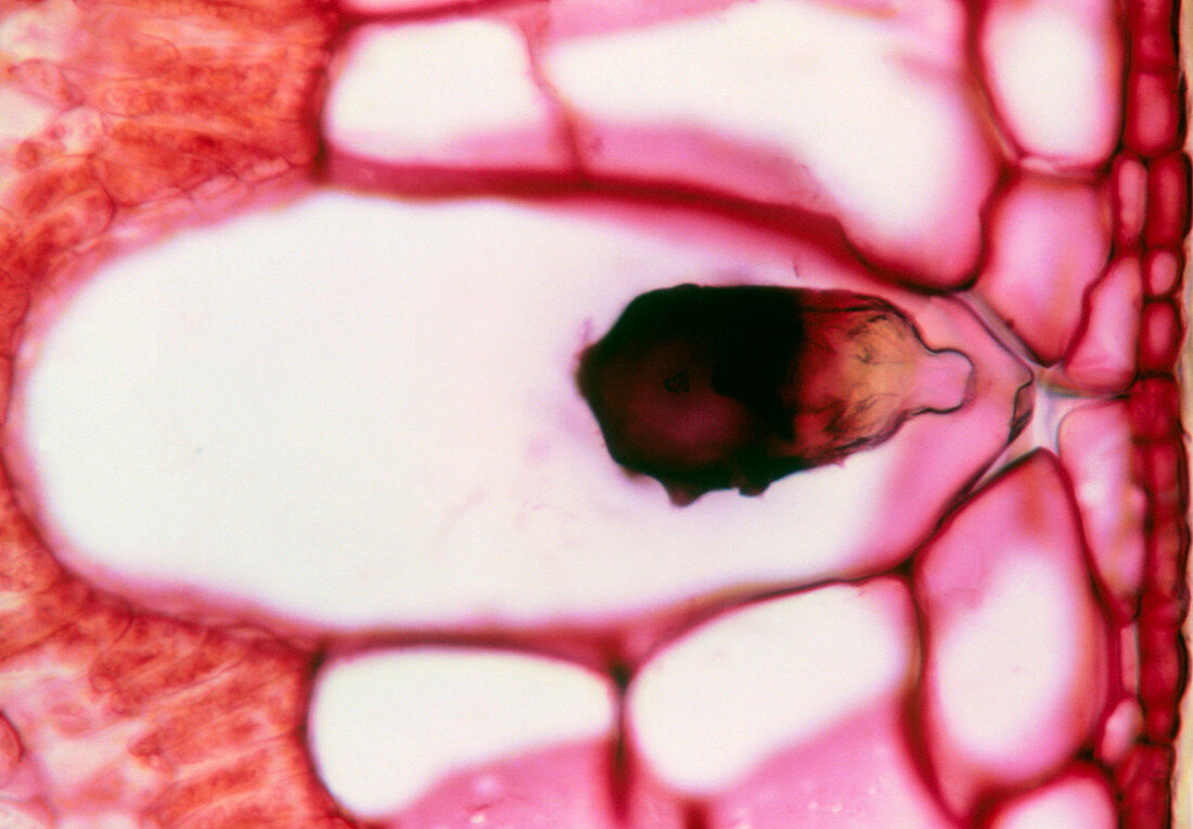 Lithocyst in a fig leaf cell