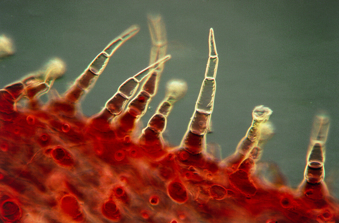 Multicellular trichomes,or leaf hairs