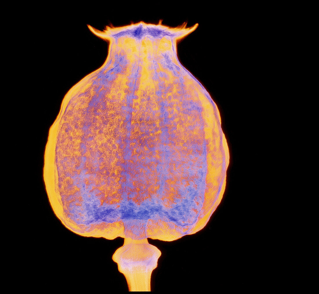 X-ray of seed capsule of Opium poppy