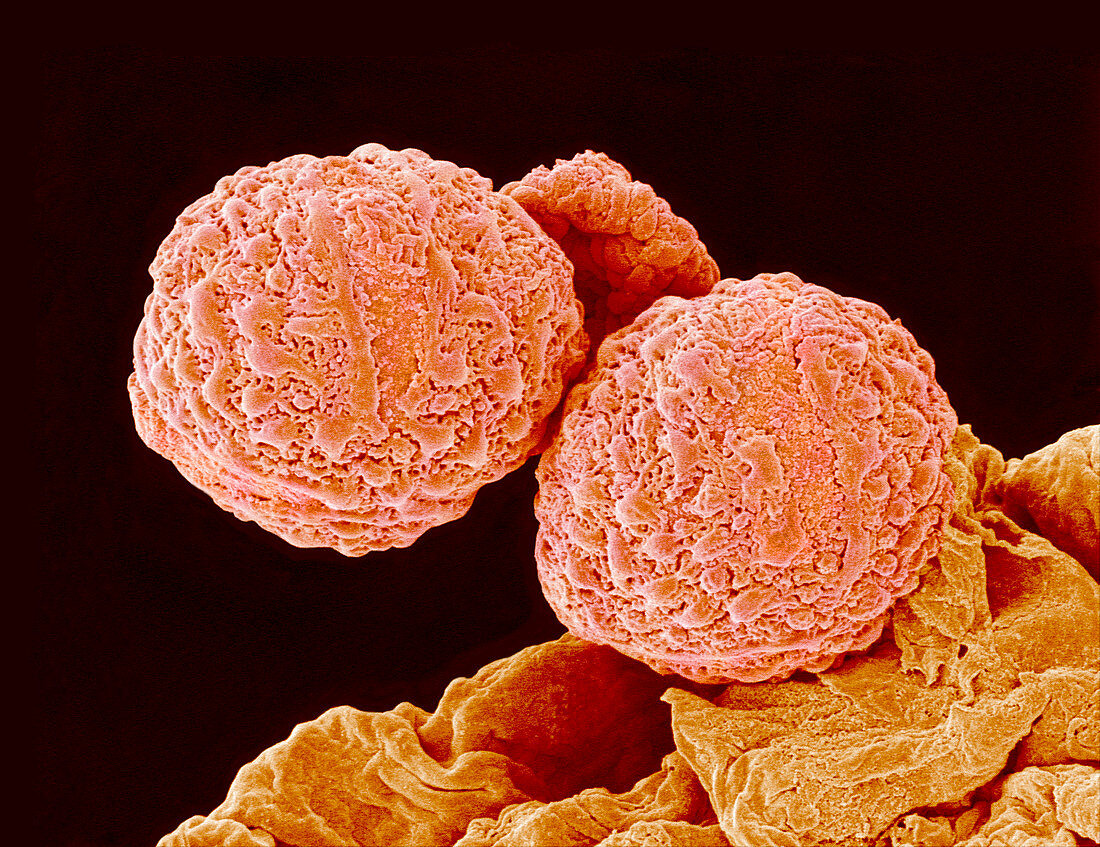 Common dewberry pollen,SEM