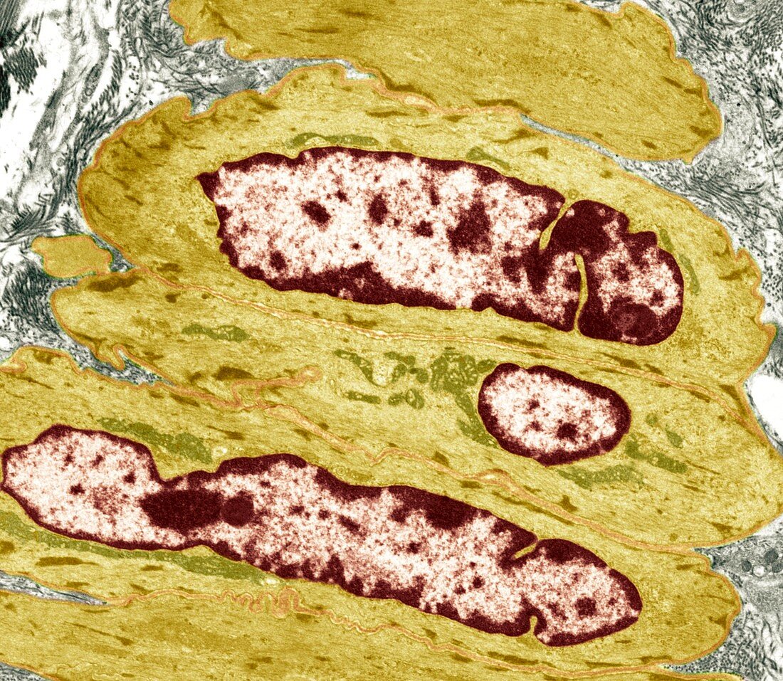 Intestinal smooth muscle cells,TEM