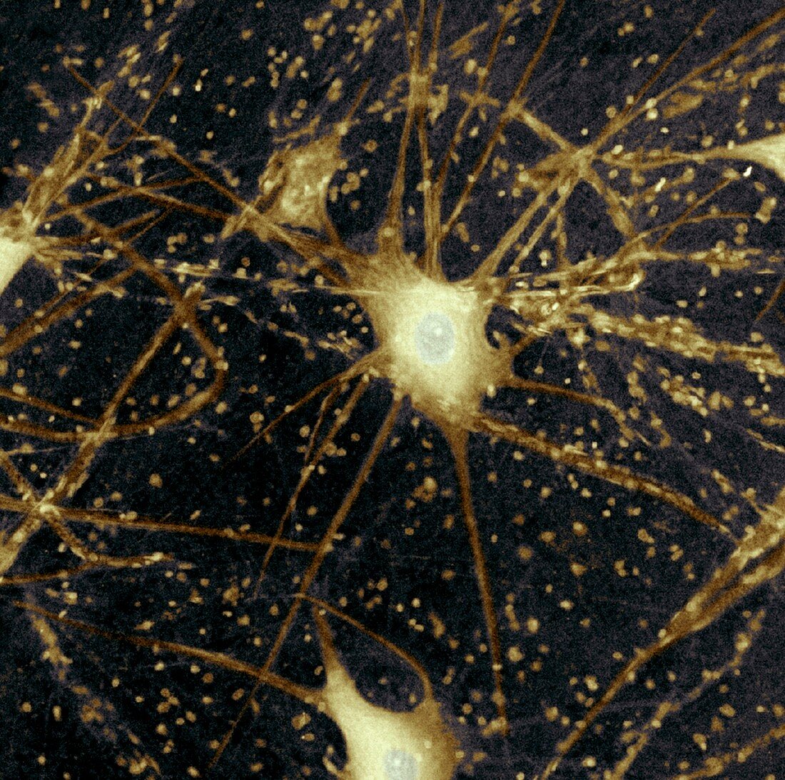 Motor neurons,light micrograph