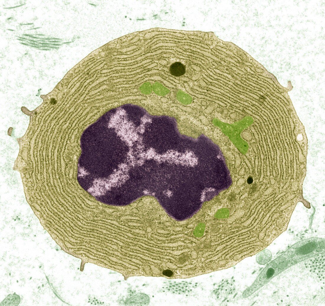 Plasma cell,TEM