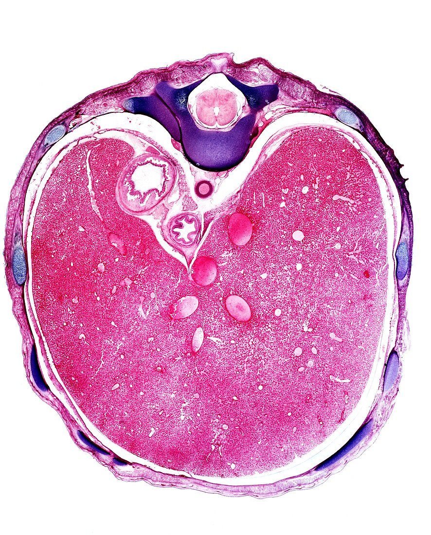 Foetus liver section,light micrograph