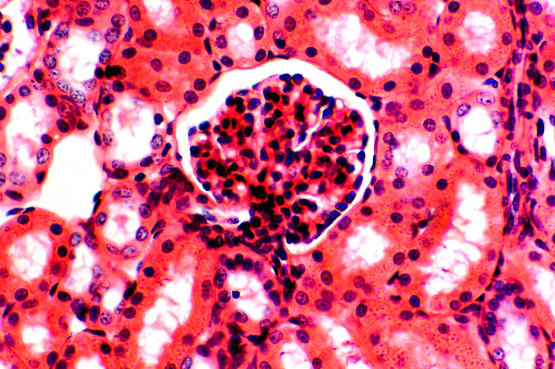 Kidney glomerulus,light micrograph
