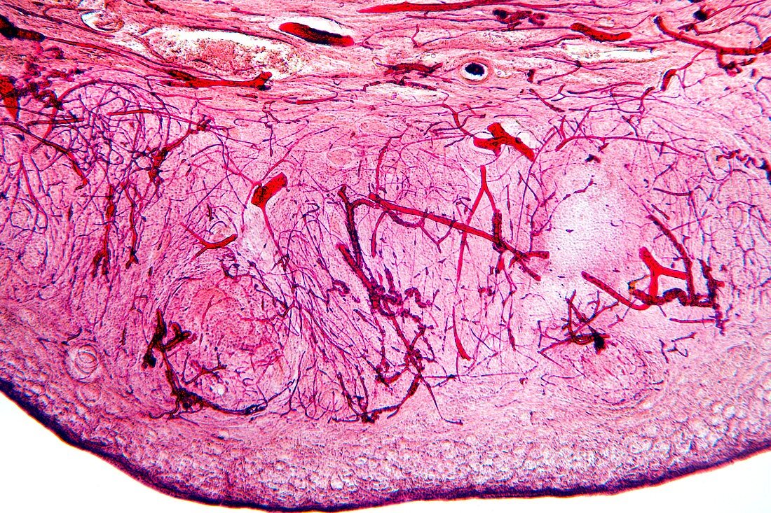 Ovary tissue,light micrograph