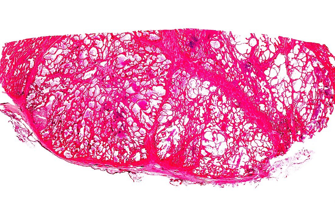 Prostate gland,light micrograph