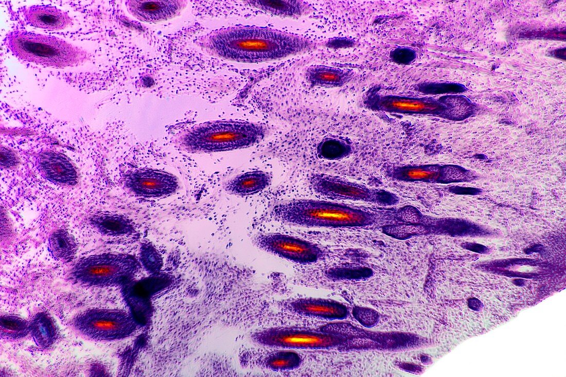 Scalp tissue,light micrograph