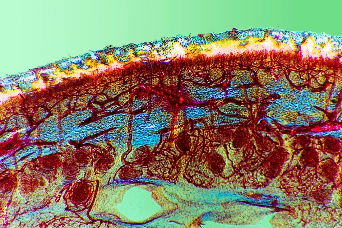 Foot skin tissue,light micrograph