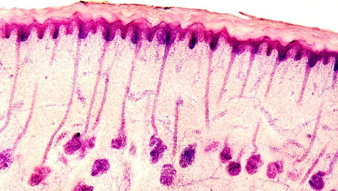 Skin sweat glands,light micrograph