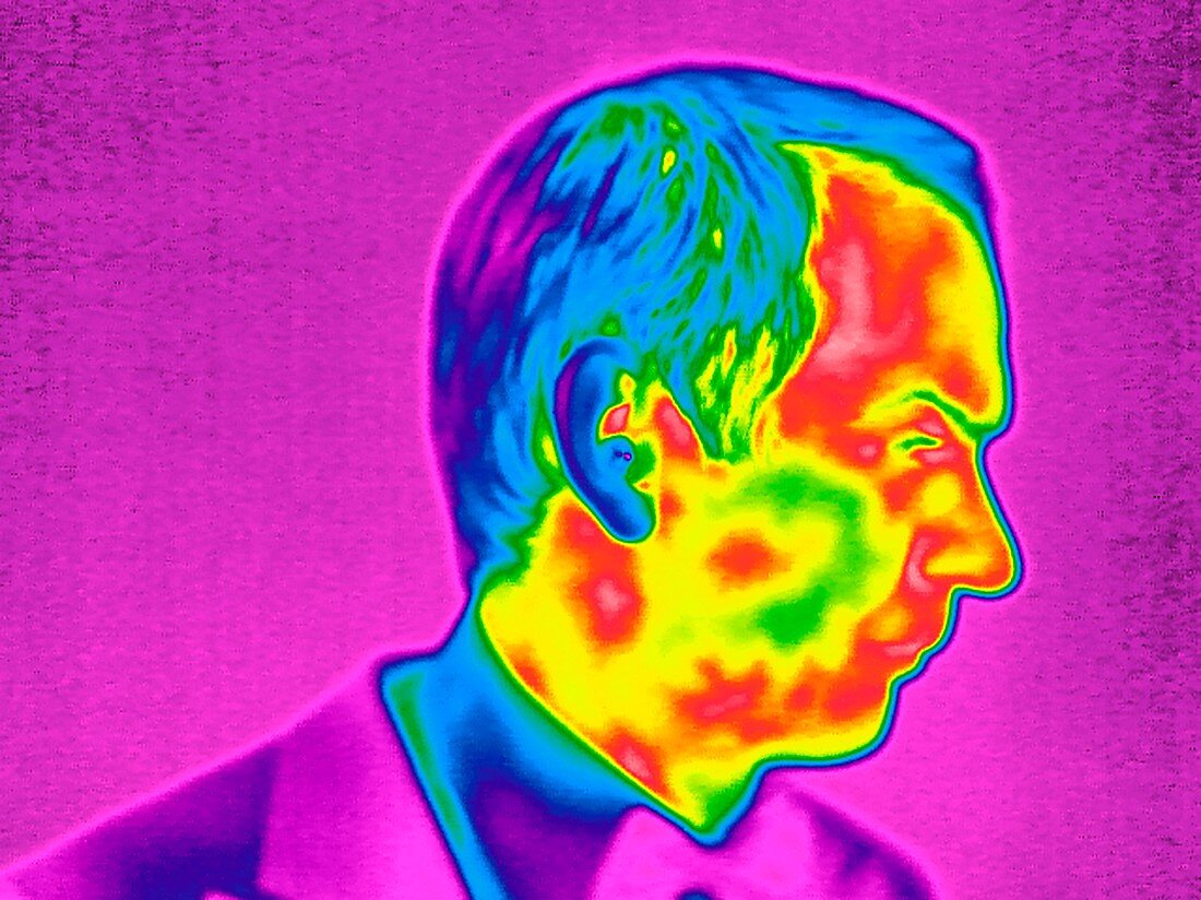 Man's face,thermogram