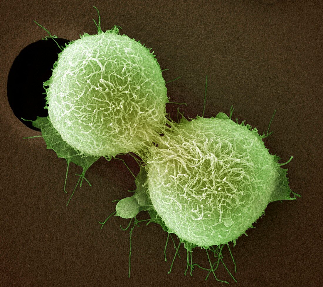 Cervical cancer cell division,SEM