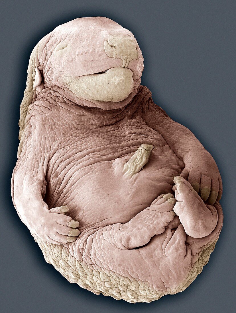 Hedgehog foetus,SEM