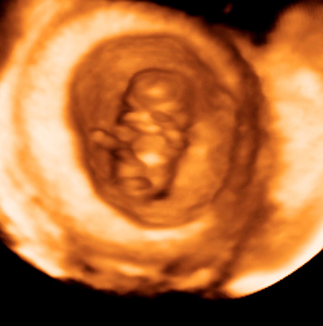 Foetus in the womb 3D ultrasound