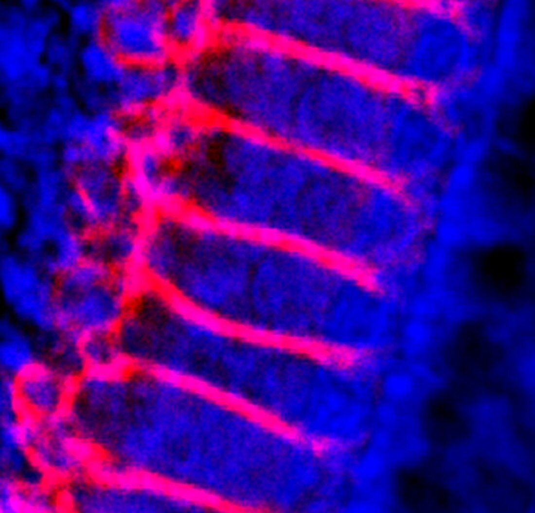 Inner ear hair cells,light micrograph