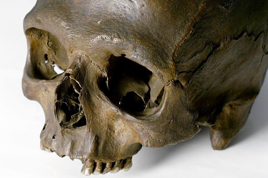 Neolithic human skull