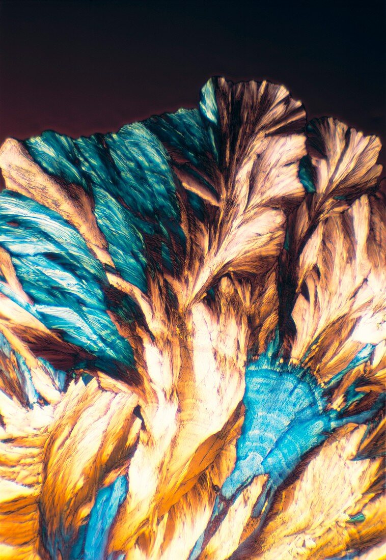 NMDA crystals,light micrograph
