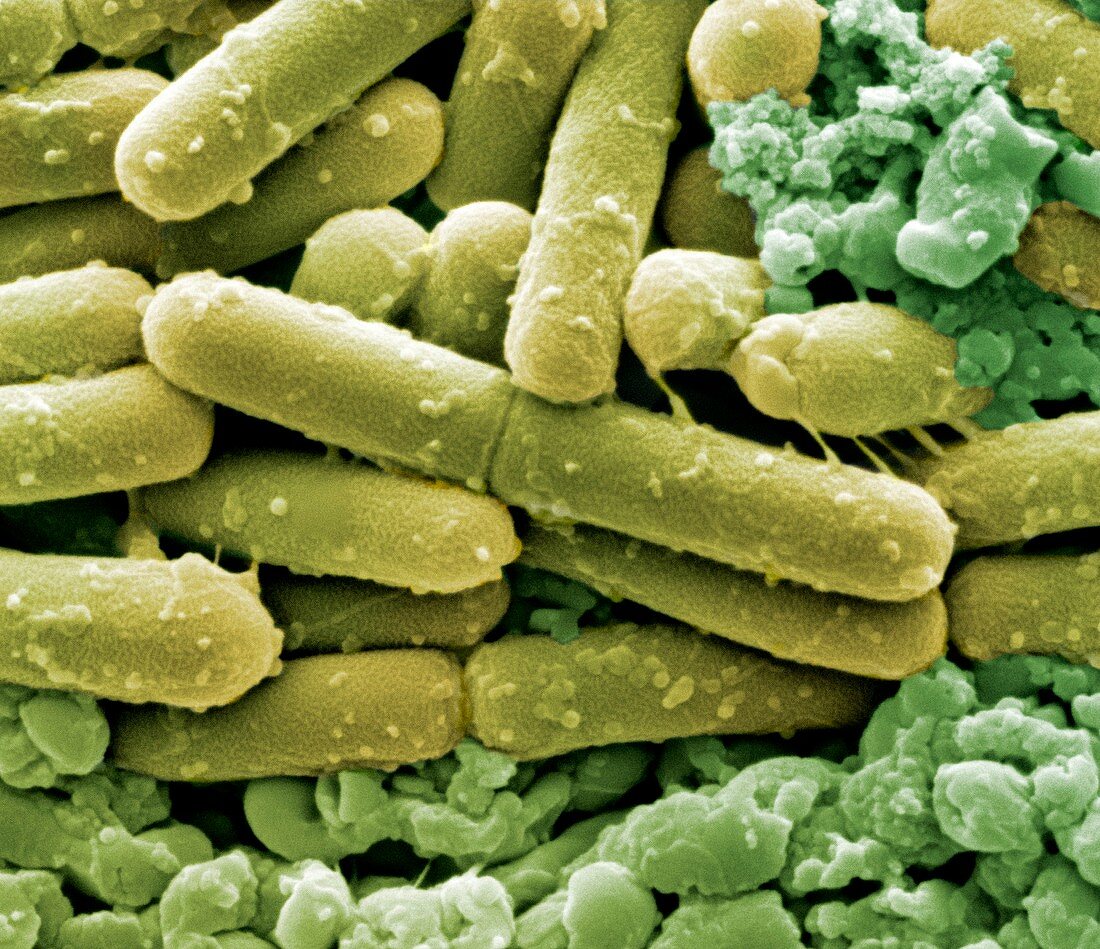Clostridium difficile bacteria,SEM