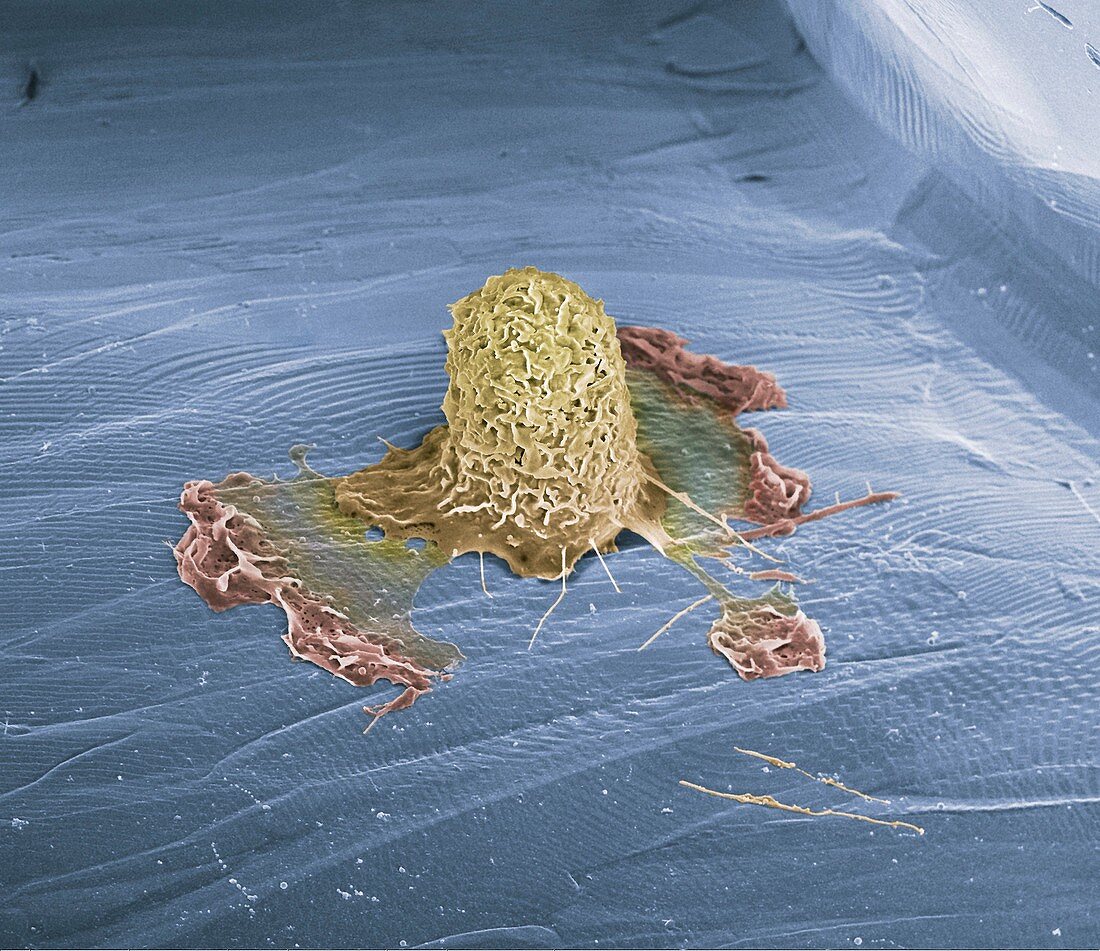 Macrophage on a titanium plate,SEM