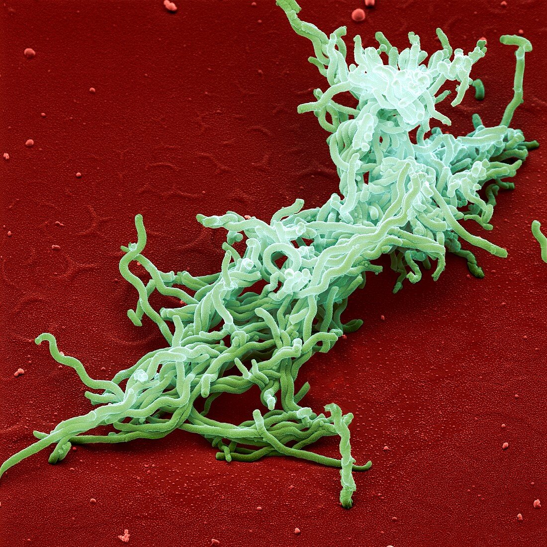 Lyme disease bacteria,SEM