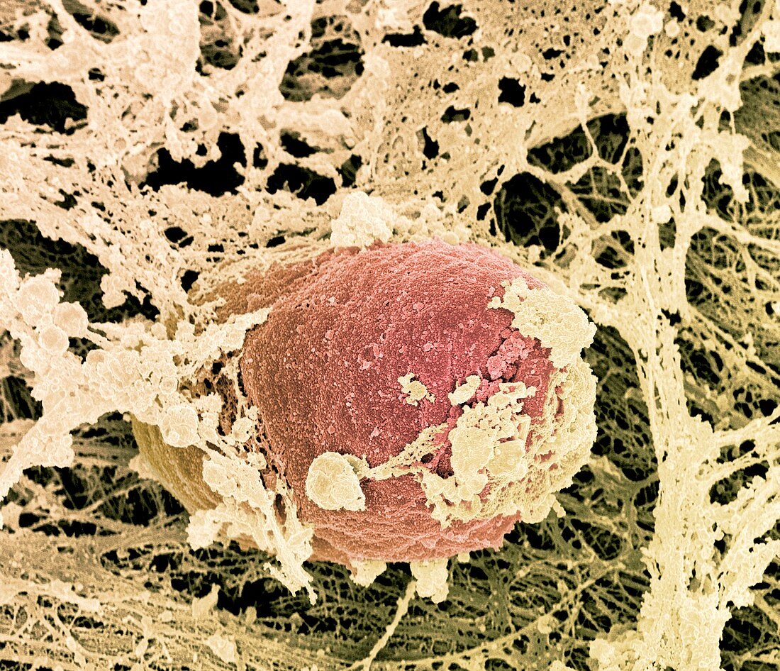 Osteoblast bone cell,SEM