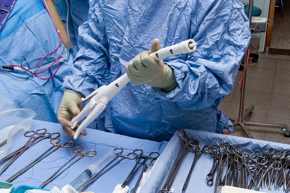 Oesophageal cancer surgery