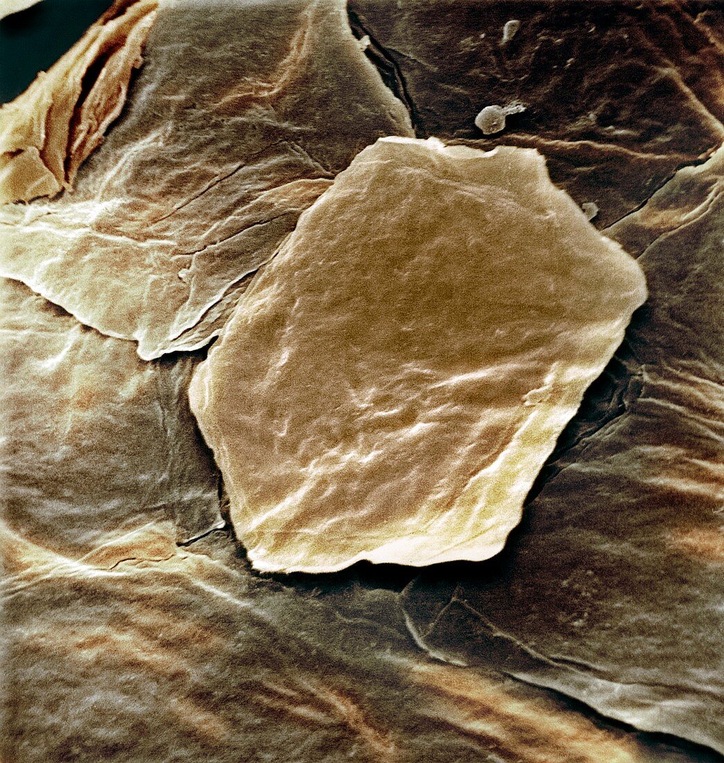 Skin cell,SEM