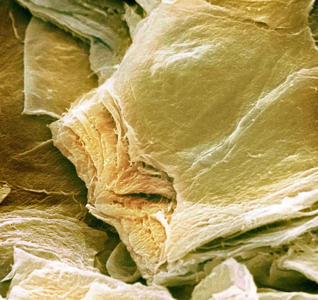 Skin surface,SEM