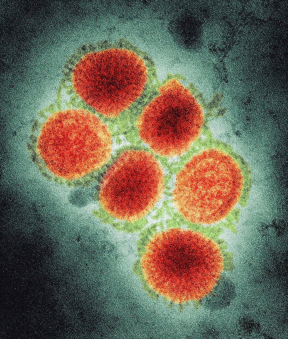 2009 H1N1 swine flu virus,TEM