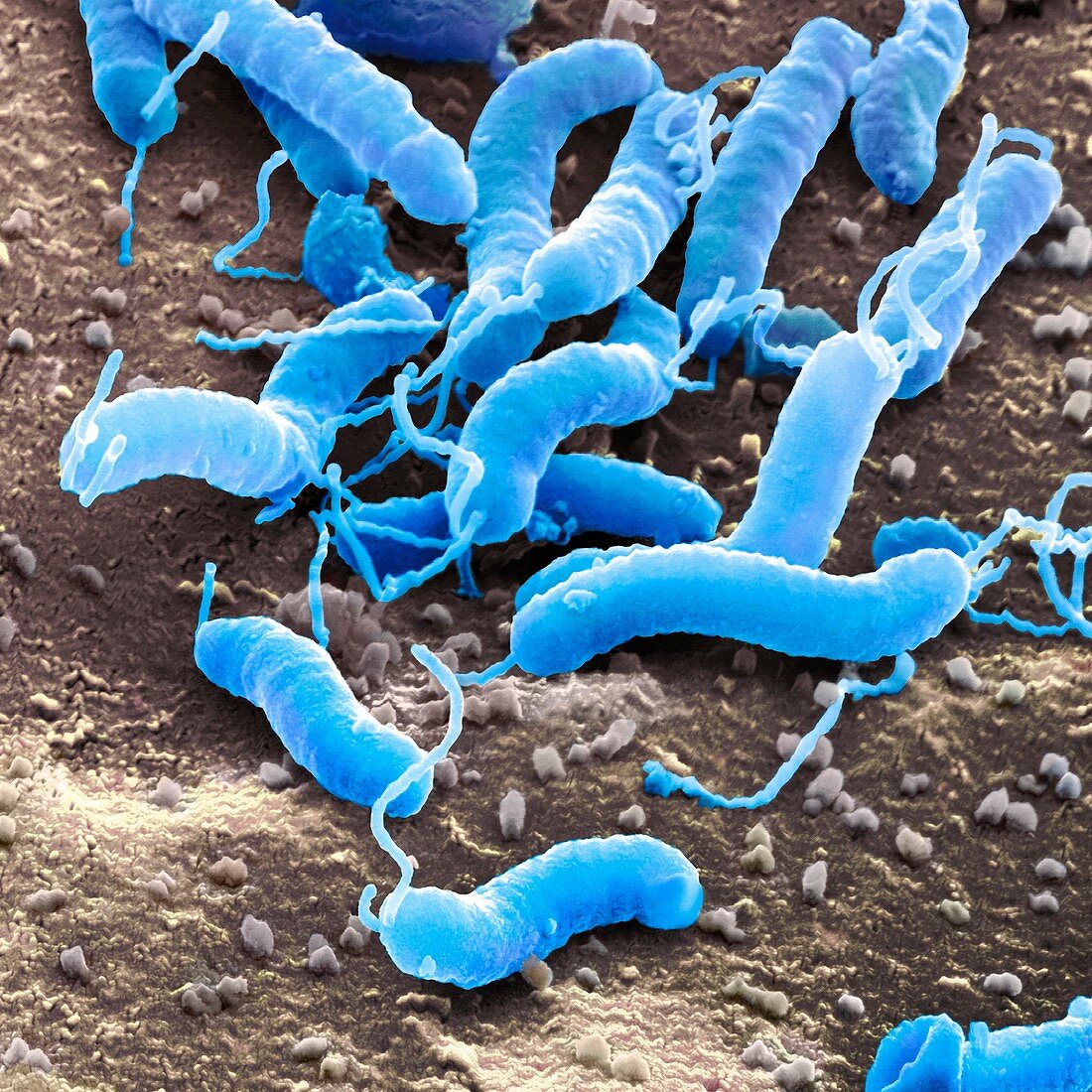 Helicobacter pylori bacteria,SEM