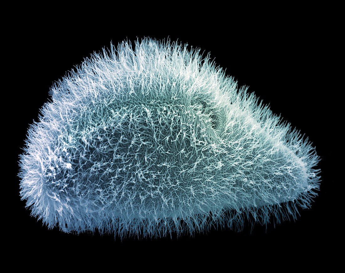 Paramecium protozoan,SEM