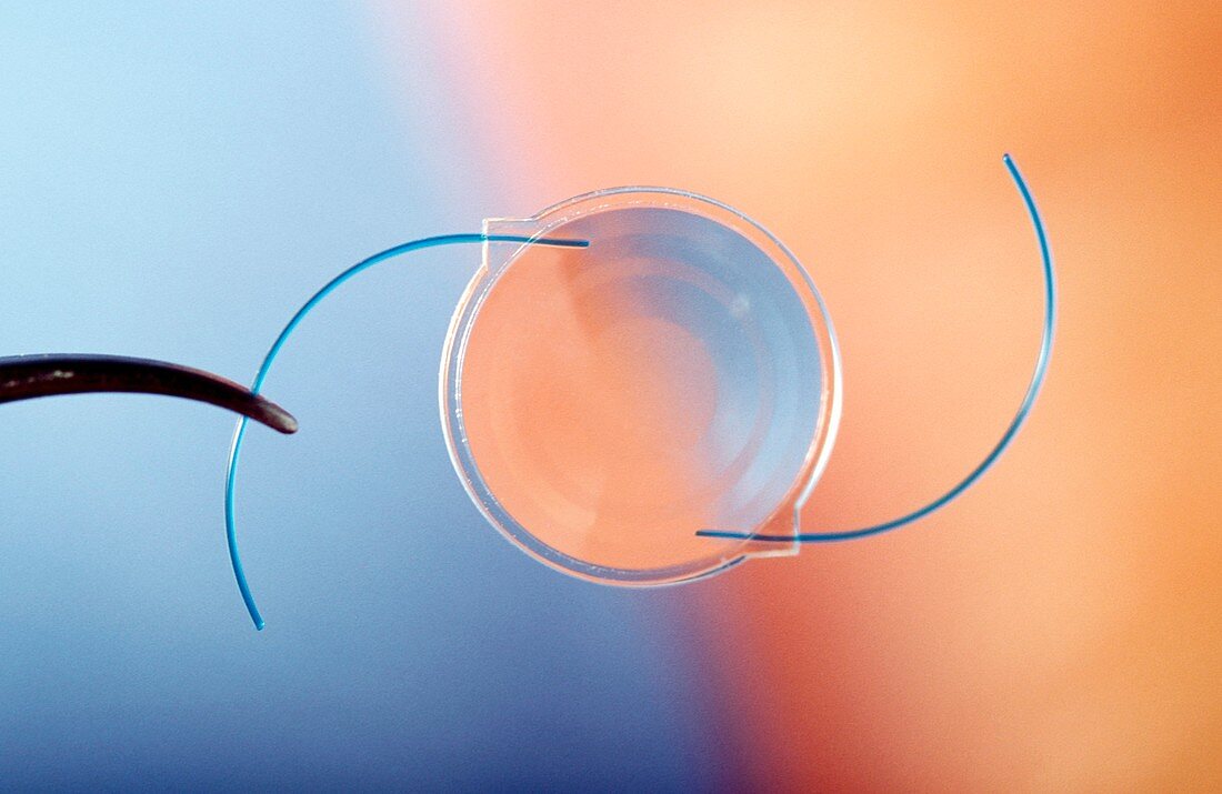 Artificial eye lens