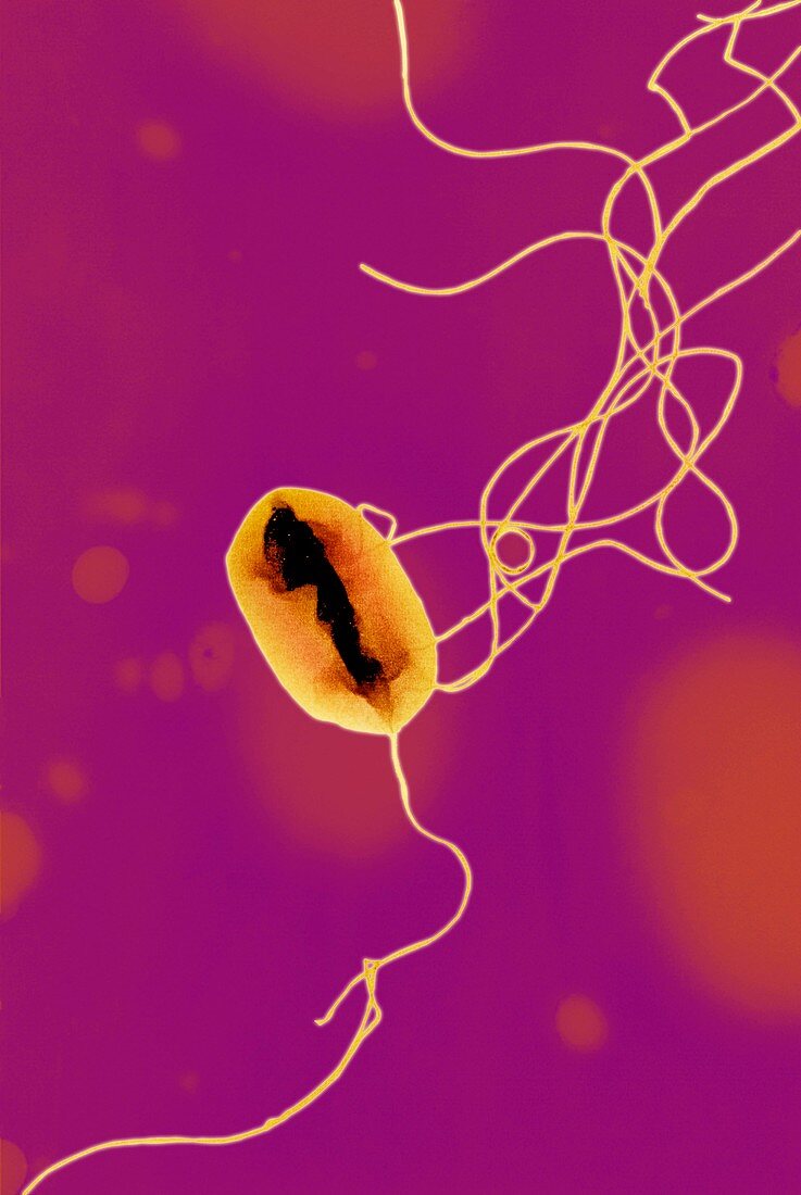 E. coli bacterium strain O157:H7,TEM