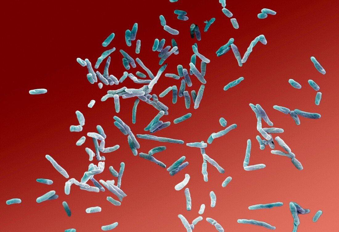 Mycobacterium chelonae bacteria,SEM