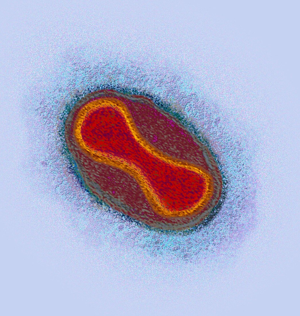 Smallpox virus particle,TEM