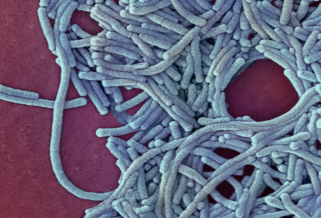 Legionella bacteria,SEM
