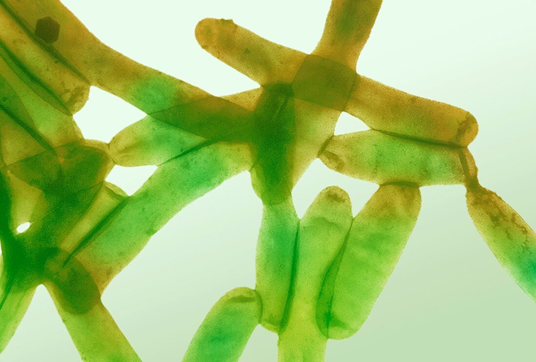 Legionella bacteria,light micrograph